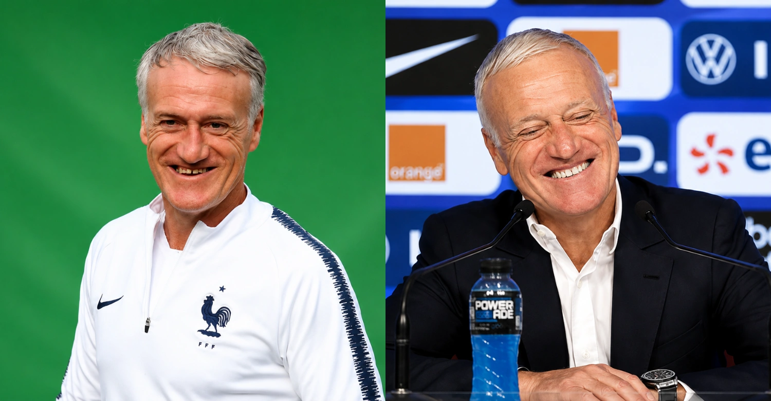 Didier Deschamps Teeth1